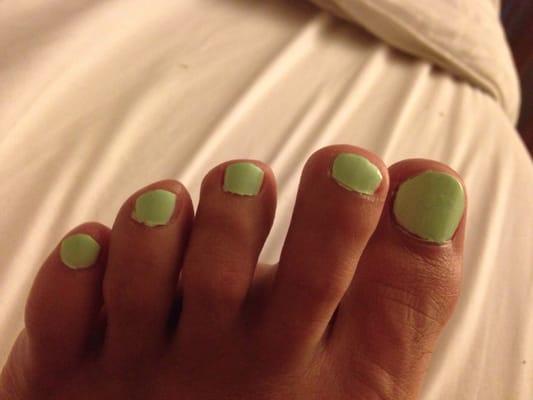 Sloppy pedicure. The polish should not be on your skin and/or your cuticles.