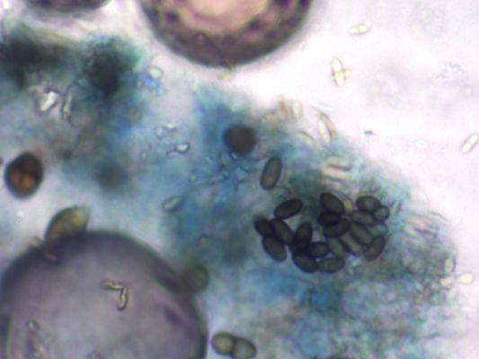 Mold Sampling under Microscopic Analysis