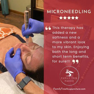 Another 5-star review for microneedling. It boosts collagen, reduces scars, wrinkles, and fine lines, and improves skin texture and tone