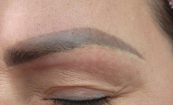 Highlight line, scaring and bare spots where hair used to grow. Gray lash line