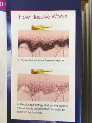 Picoway Resolve rejuvenation