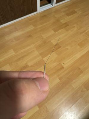 Acupuncture needle she just left in my body