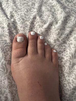 Toe nails