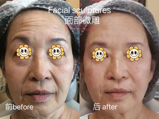 Whole Face Makeover