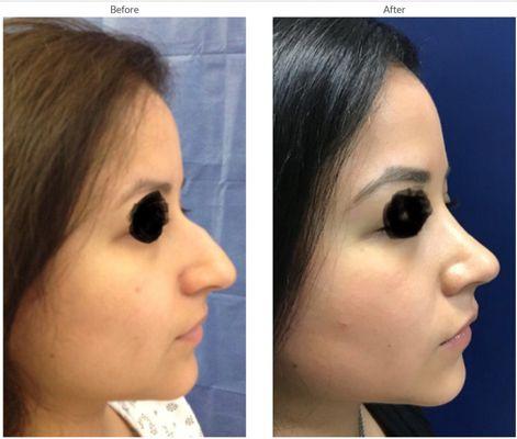 Dr. Moreano is a nose expert