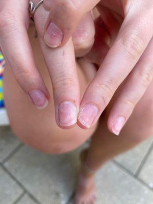 Cuts on sides of nails from drill