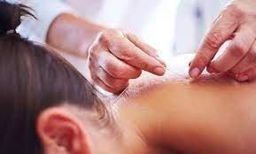 Acupuncture for neck & back pain