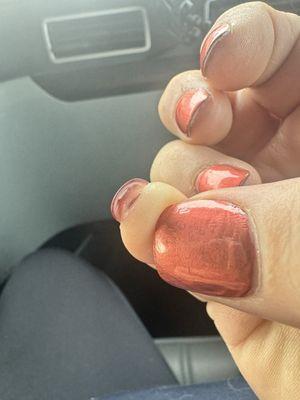 More burn under nails