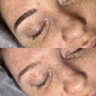 Microblading