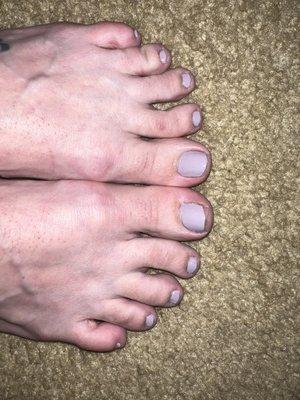 Awful pedicure