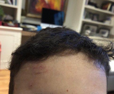 The lady cut my 4 y/o's  forehead and gave him the worst haircut ever. My only instruction: long on top, shorter in the sides!!