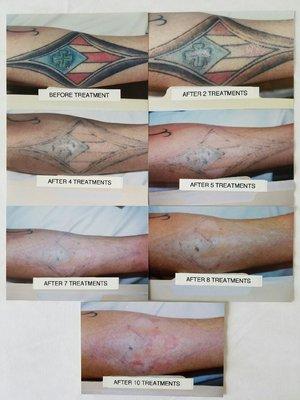 Blue, red and black ink. 10 treatments.