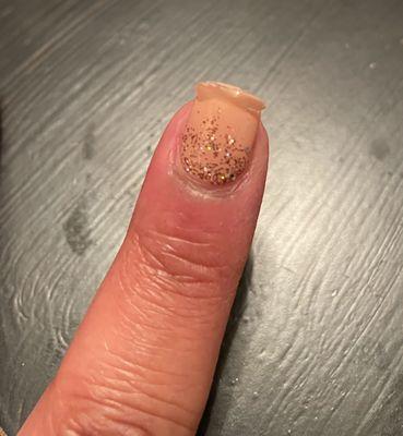 Chipped/ peeling gel polish