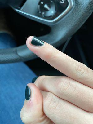 Bad nail job.