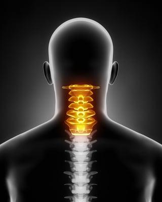 South Carolina Chiropractor in Murrells Inlet, Huntington Beach, and Garden City