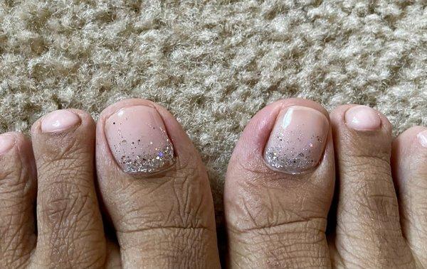 Right toe inflammation from rough pedicure