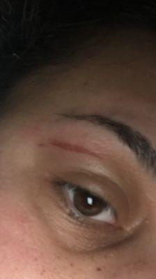 I got my eye brows done. My skin is super sensitive. It always gets red and puffy after a wax however I have NEVER gotten a burn mark.