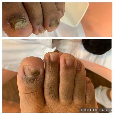 Waterless pedi deep breakdown without restoration