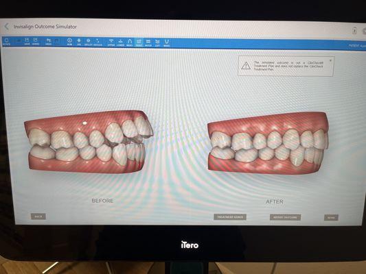 Initial scan of possible before and after