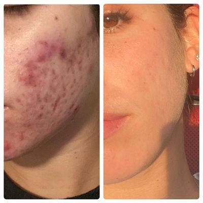 Client before & after.