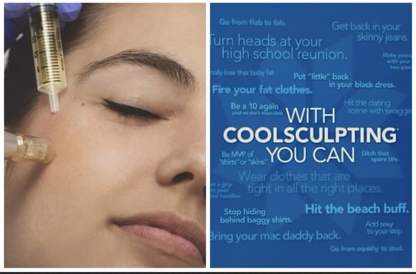 coolsculpting and fraxel