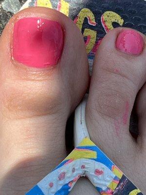 Can't believe I'm posting a foot pic but look at this mess!