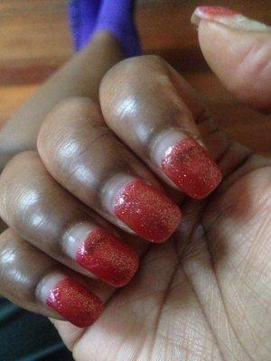 Nail fungus underneath gel and gel polish