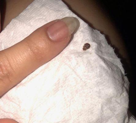 Typical size of a bedbug compared to a ladies finger