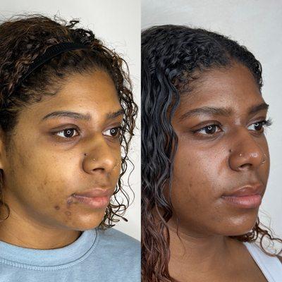 Glass Skin Regimen by Galore Medical