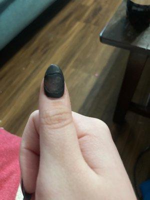 peeling nail