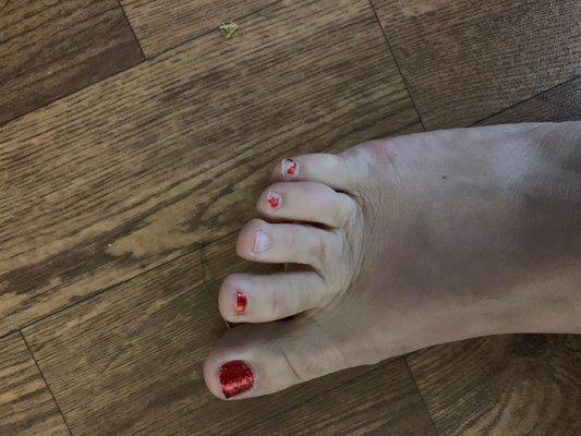 1 Week after Pedicure