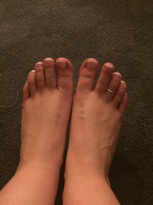 My feet a week after getting them done at Young Nails