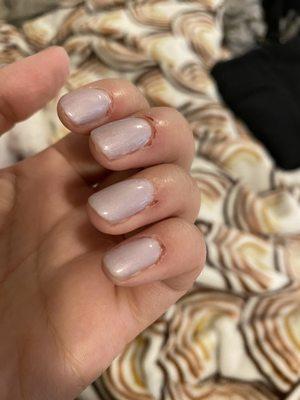 Ripped and raw cuticles