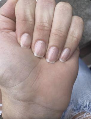 Dirty nails. Not cut straight.