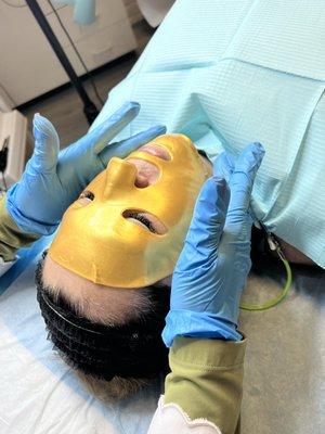 Gold peel facial