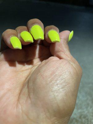 Tips of nails and cuticle cuts