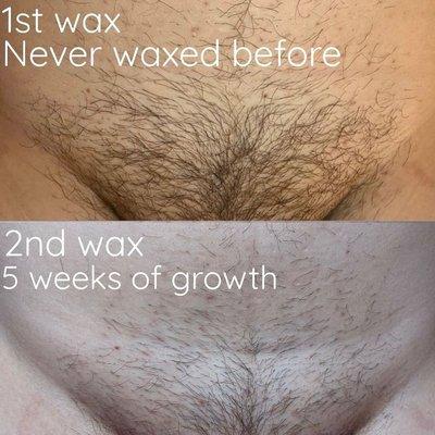 Hair get thinner every time you wax