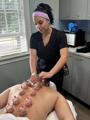 Alejandra performing cupping therapy