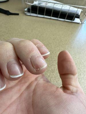 Broken nail