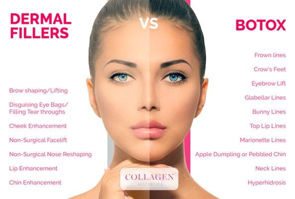 Fillers by Allergan and Versa. Natural Hyaluronic acid