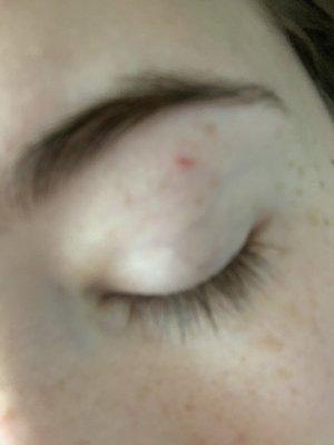 Cut left eyebrow from threading