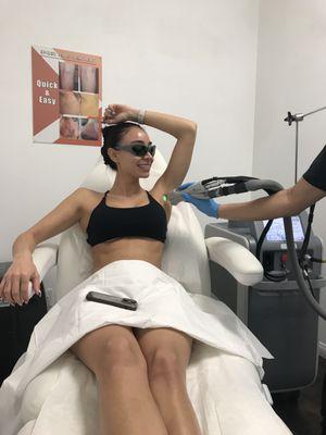 Underarm laser hair removal