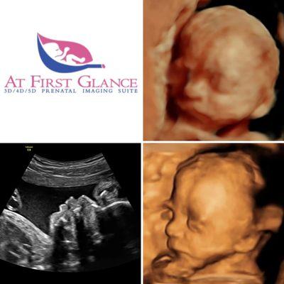 At First Glance 3D/4D Prenatal Ultrasound Studio