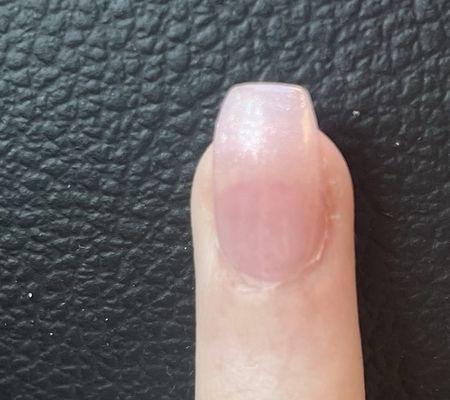 Terrible nail sculpting around my ring finger's cuticle