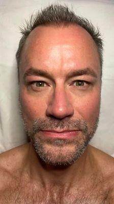 The results of a beard facial for men