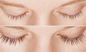 latisse eyelash enhancers