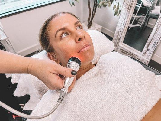 RF Facial Treatment anti aging