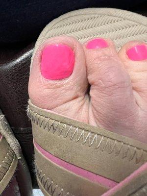 The pedicure results from this salon