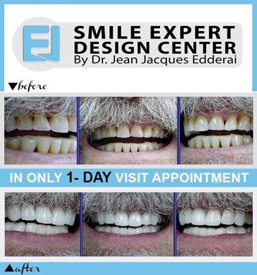 SMILE MAKEOVER IN ONE VISIT APPOINTMENT