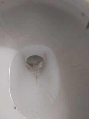 nasty stain in toilet